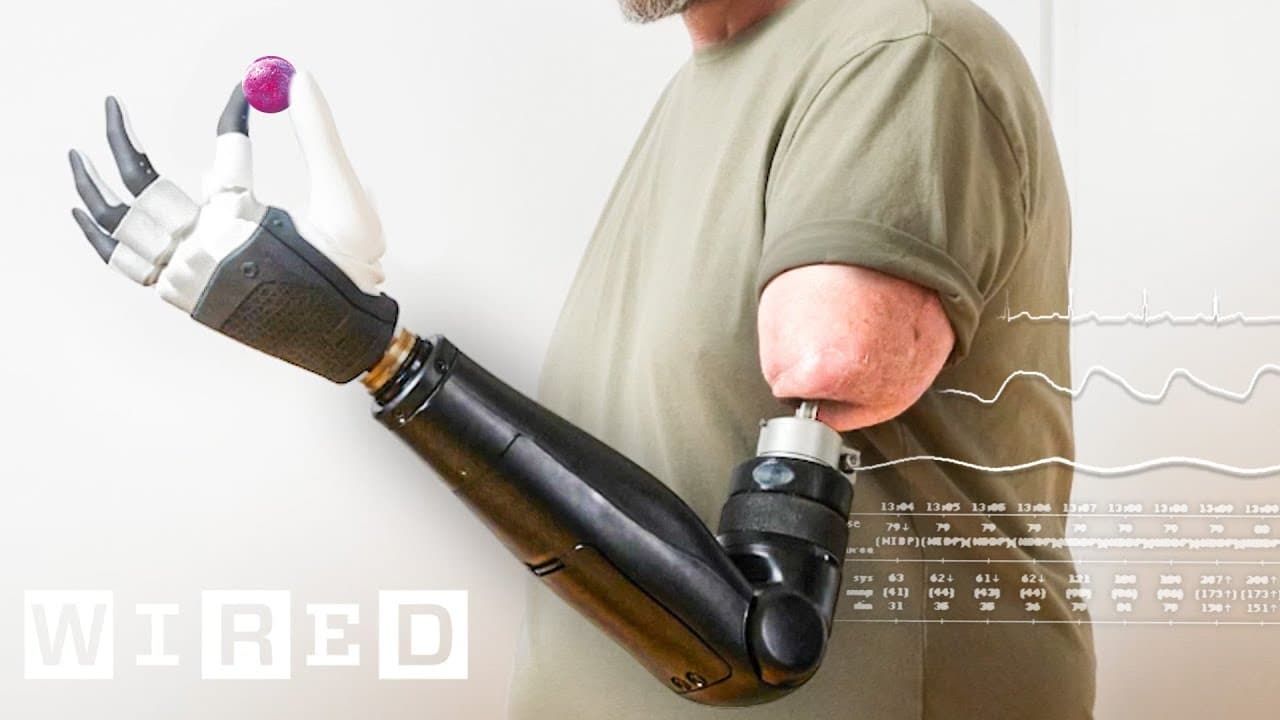 Pioneering the Pathway to Prosthetic Perfection: A Mind-Controlled Bionic Arm